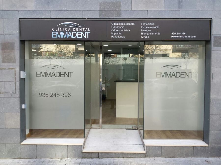 escaparate de vidrio con U de acero inoxidable