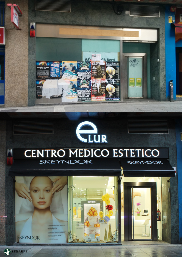 Antes y después fachada