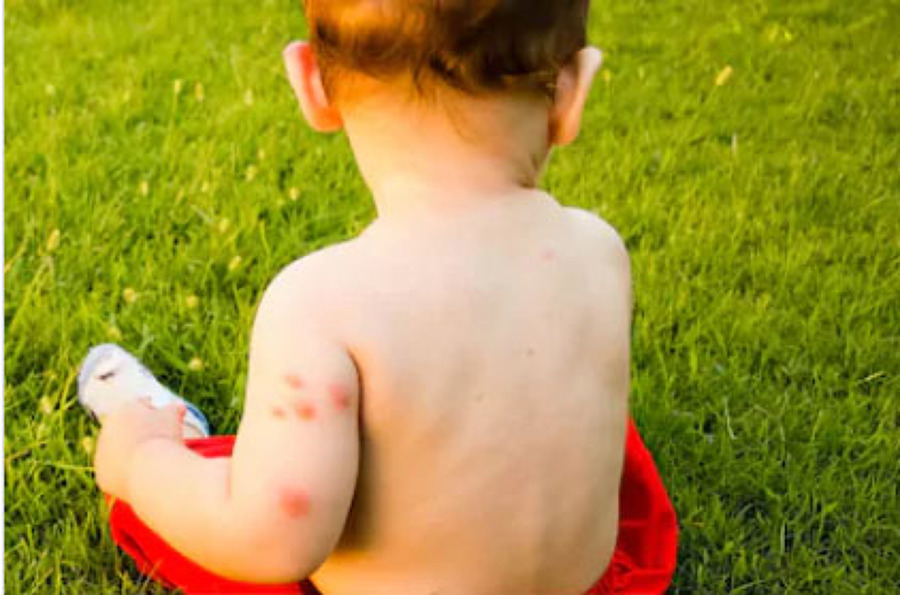 Control de plagas de Insectos