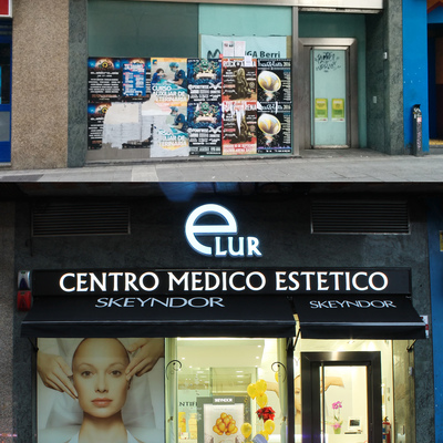 Antes y después fachada